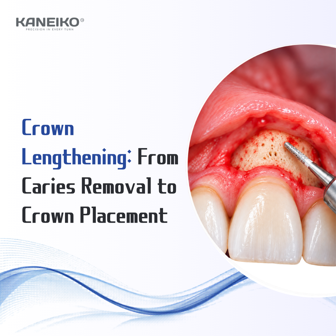Kaneiko crown lengthening procedure guide showing surgical bur contouring exposed alveolar bone, from deep caries removal to final crown placement.