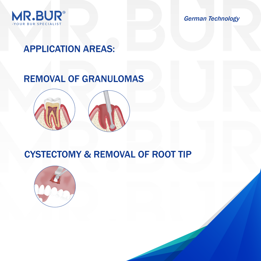Advertisement for MR.BUR dental tool with application areas for removal of granulomas and cystectomy & removal of root tip on a white background