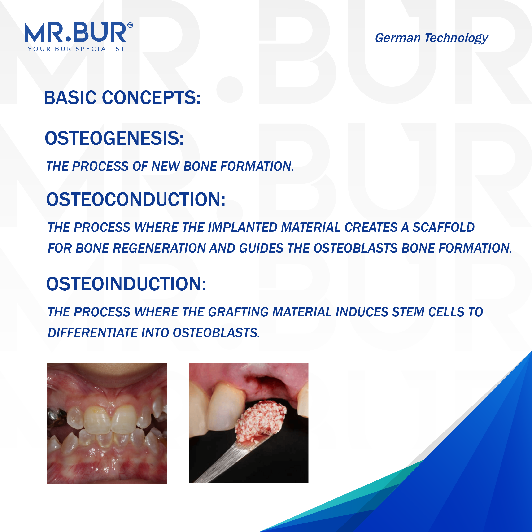 MR.BUR dental product advertisement with text on bone formation concepts and images of dental procedures.