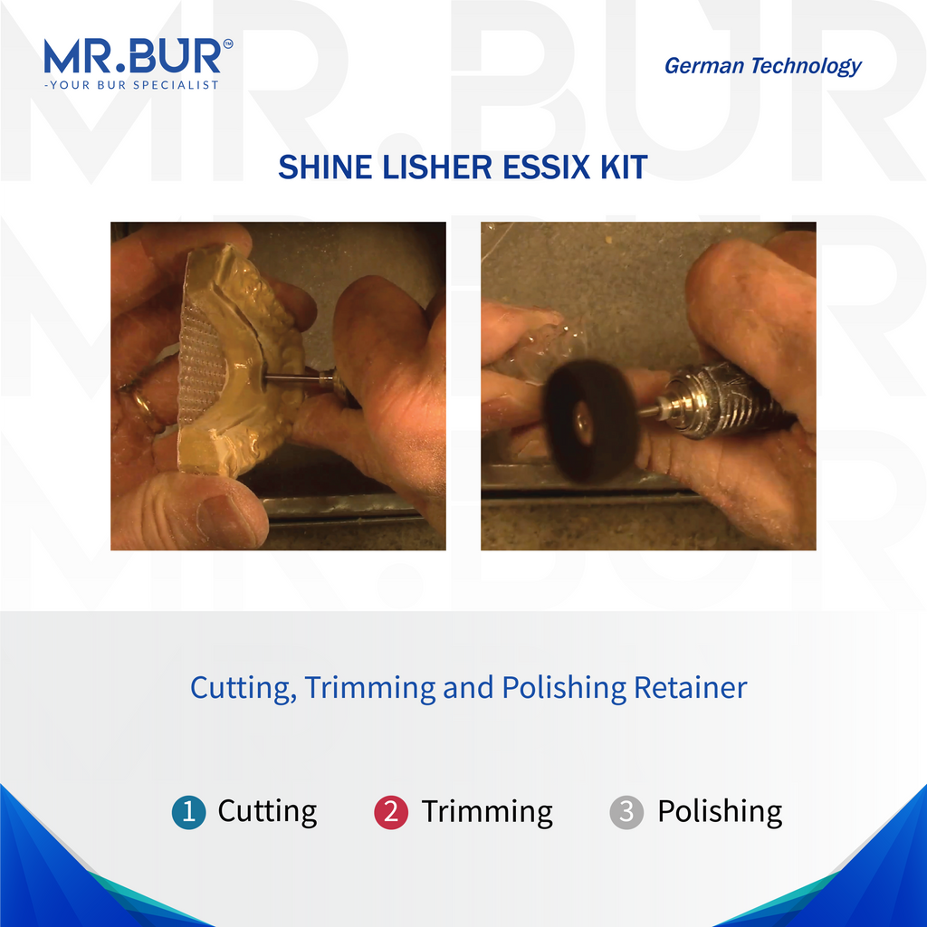 This image shows the procedure of using retainer polishing bur sold by Mr Bur on retainer final touch